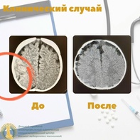 

Чудо под Новый год: история спасения маленького пациента рисунок
