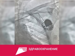 

В Елизаветинской больнице впервые провели операцию по установке электрокардиостимулятора рисунок
