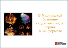 

В Мариинской больнице кардиологи видят сердце в 3D-формате рисунок
